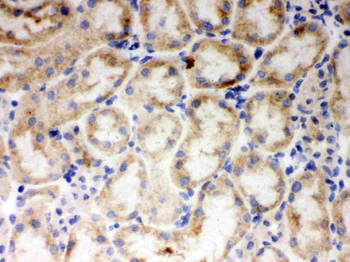 Cytochrome P450 1A1/CYP1A1 Rabbit Polyclonal Antibody