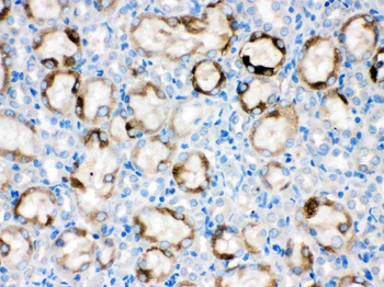Cytochrome P450 1A1/CYP1A1 Rabbit Polyclonal Antibody