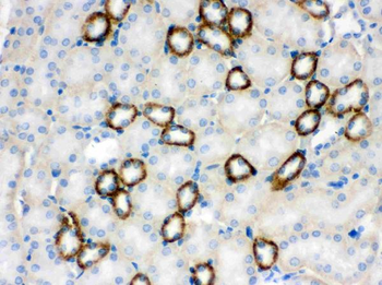 CYP1B1 Rabbit Polyclonal Antibody