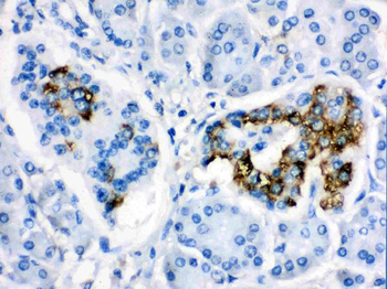 CYP24A1 Rabbit Polyclonal Antibody