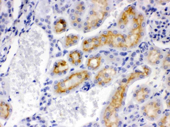 CYP24A1 Rabbit Polyclonal Antibody