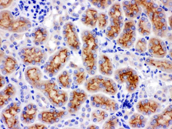CYP24A1 Rabbit Polyclonal Antibody