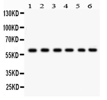 CYP24A1 Rabbit Polyclonal Antibody