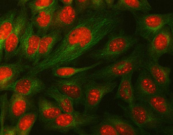 Daxx Rabbit Polyclonal Antibody