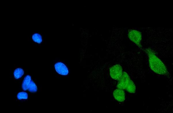 Daxx Rabbit Polyclonal Antibody