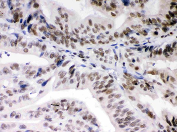 Daxx Rabbit Polyclonal Antibody