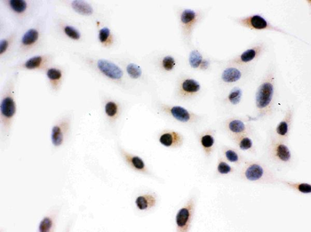 Daxx Rabbit Polyclonal Antibody