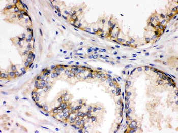 SAP97/DLG1 Rabbit Polyclonal Antibody