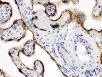 Endothelin B Receptor/EDNRB Rabbit Polyclonal Antibody