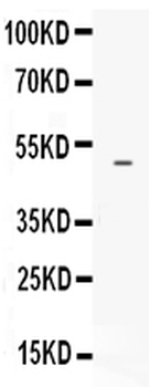 Endothelin B Receptor/EDNRB Rabbit Polyclonal Antibody