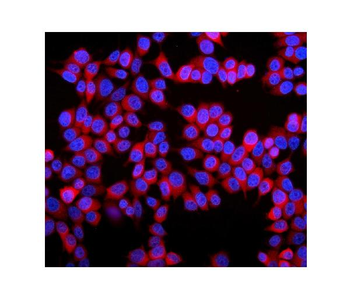 Stathmin 1/STMN1 Rabbit Polyclonal Antibody
