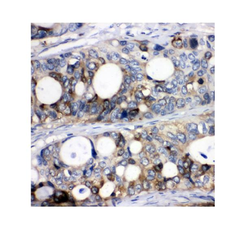 Stathmin 1/STMN1 Rabbit Polyclonal Antibody