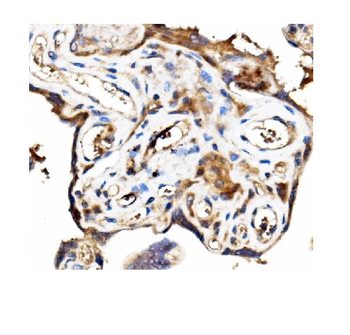 Stathmin 1/STMN1 Rabbit Polyclonal Antibody