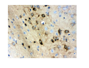 Stathmin 1/STMN1 Rabbit Polyclonal Antibody