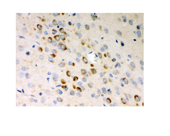 Stathmin 1/STMN1 Rabbit Polyclonal Antibody