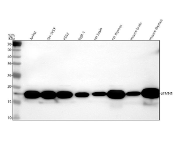 Stathmin 1/STMN1 Rabbit Polyclonal Antibody