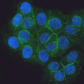 E Cadherin 1/CDH1 Rabbit Polyclonal Antibody