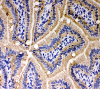 E Cadherin 1/CDH1 Rabbit Polyclonal Antibody