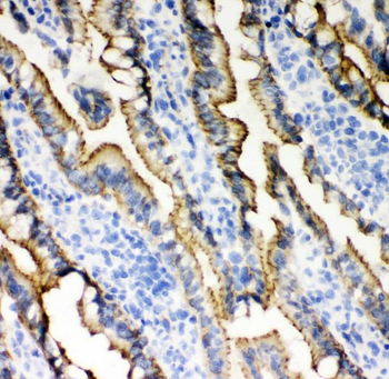 E Cadherin 1/CDH1 Rabbit Polyclonal Antibody