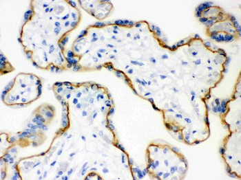 E Cadherin 1/CDH1 Rabbit Polyclonal Antibody