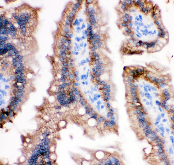 E Cadherin 1/CDH1 Rabbit Polyclonal Antibody