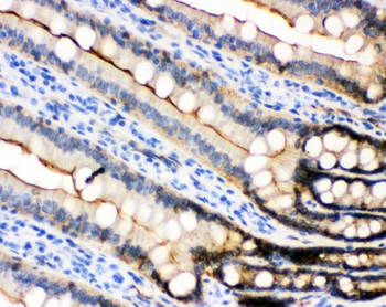 E Cadherin 1/CDH1 Rabbit Polyclonal Antibody