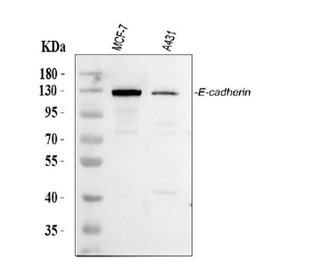 E Cadherin 1/CDH1 Rabbit Polyclonal Antibody