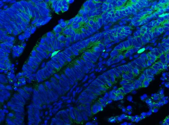 E Cadherin 1/CDH1 Rabbit Polyclonal Antibody