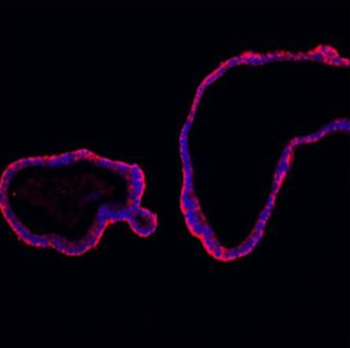 E Cadherin 1/CDH1 Rabbit Polyclonal Antibody