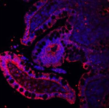 E Cadherin 1/CDH1 Rabbit Polyclonal Antibody