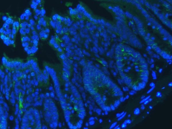 E Cadherin 1/CDH1 Rabbit Polyclonal Antibody