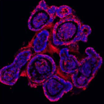 E Cadherin 1/CDH1 Rabbit Polyclonal Antibody