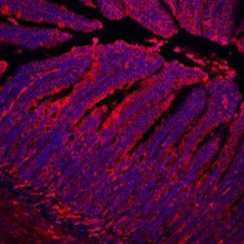 E Cadherin 1/CDH1 Rabbit Polyclonal Antibody