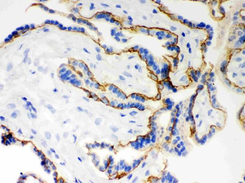 E Cadherin 1/CDH1 Rabbit Polyclonal Antibody