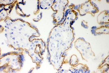 E Cadherin 1/CDH1 Rabbit Polyclonal Antibody