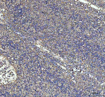 G-CSF/CSF3/CSF Rabbit Polyclonal Antibody