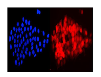 Cystatin A/CSTA Rabbit Polyclonal Antibody