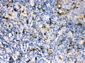 Cystatin A/CSTA Rabbit Polyclonal Antibody