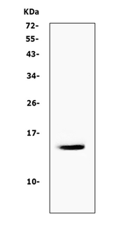 Cystatin A/CSTA Rabbit Polyclonal Antibody
