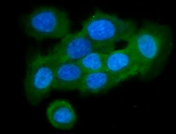 Stefin B/CSTB Rabbit Polyclonal Antibody