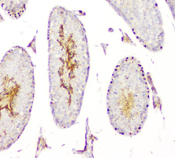 DMRT1 Rabbit Polyclonal Antibody