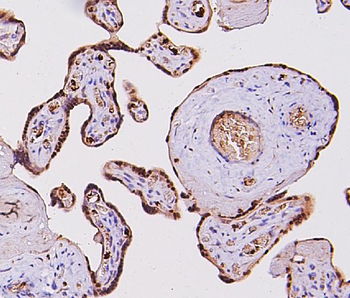 Fos B/FOSB Rabbit Polyclonal Antibody