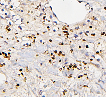 Fos B/FOSB Rabbit Polyclonal Antibody