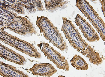 Fos B/FOSB Rabbit Polyclonal Antibody