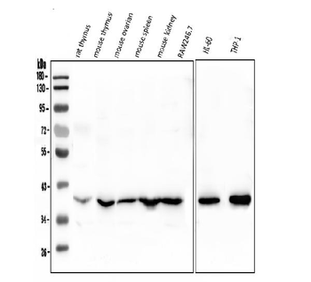 Fos B/FOSB Rabbit Polyclonal Antibody
