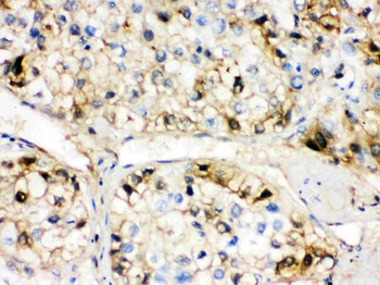 AHSG Rabbit Polyclonal Antibody