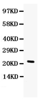 G-CSF/CSF3/CSF Rabbit Polyclonal Antibody