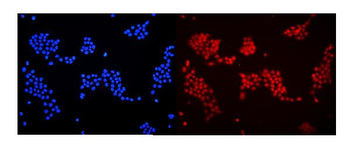 DDB1 Rabbit Polyclonal Antibody