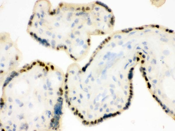 DDB1 Rabbit Polyclonal Antibody