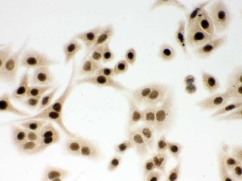 DDB1 Rabbit Polyclonal Antibody